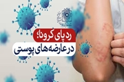 رییس بخش عفونی بیمارستان مسیح دانشوری اظهار کرد : رد پای ویروس کرونا در عارضه های پوستی